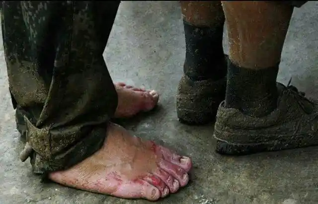 破点皮就嚷嚷的那些人来看看抗洪战士的脚致敬军人!返回搜狐,查看更多