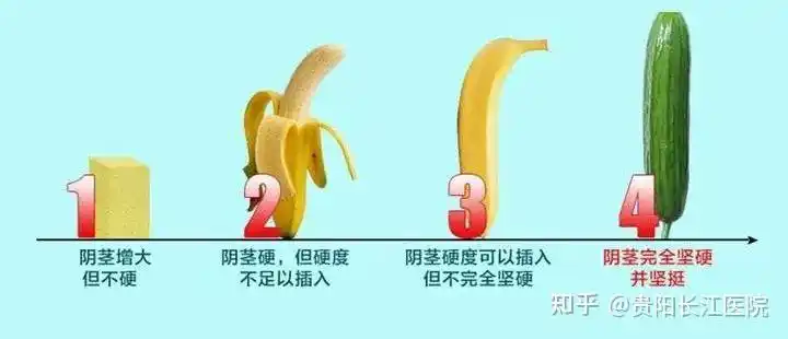 贵阳长江医院:丁丁硬度不够,轻松预防阳痿!